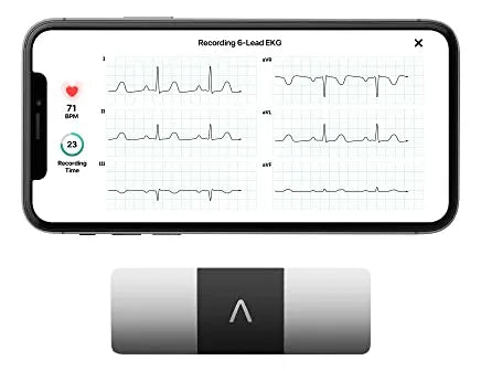 Omron HeartScan 6L ao lado do celular mostrando o ECG de 6 derivações